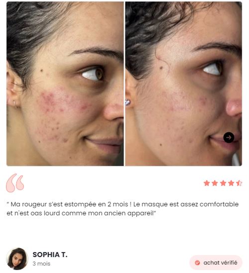Helio⁺     Masque infrarouge